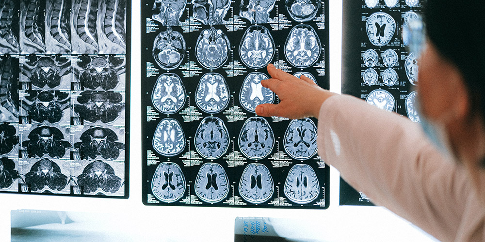 NEUROLOGICAL CONDITIONS